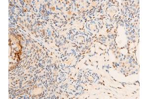 ABIN6267286 at 1/100 staining rat ovarian tissue sections by IHC-P.