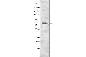 Western blot analysis OCT1 using K562 whole cell lysates (SLC22A1 anticorps  (N-Term))