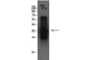 Western Blot analysis of Cystatin C protein using CST3 Monoclonal Antibody at dilution of 1:1000. (CST3 anticorps)