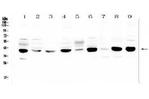 Western blot analysis of MCUR1 using anti-MCUR1 antibody (ABIN6719261).