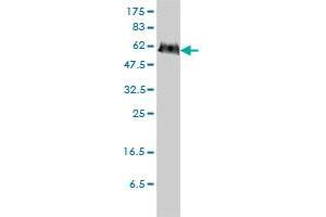 PGM3 monoclonal antibody (M01), clone 1E2-1B12 Western Blot analysis of PGM3 expression in HeLa . (Phosphoglucomutase 3 anticorps  (AA 1-542))