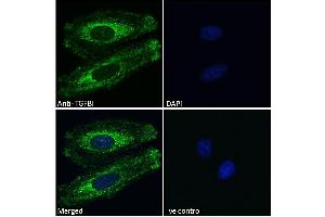 ABIN571098 Immunofluorescence analysis of paraformaldehyde fixed HeLa cells, permeabilized with 0.