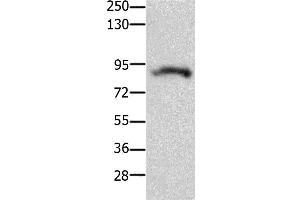 Western Blotting (WB) image for anti-Potassium Voltage-Gated Channel, Subfamily H (Eag-Related), Member 2 (KCNH2) antibody (ABIN2426047)