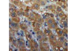 Used in DAB staining on fromalin fixed paraffin-embedded Liver tissue (LIPG anticorps  (AA 115-369))