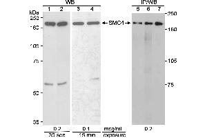 Immunoprecipitation (IP) image for anti-Structural Maintenance of Chromosomes 4 (SMC4) (C-Term) antibody (ABIN7453334)