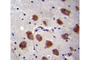 BMPR1B antibody immunohistochemistry analysis in formalin fixed and paraffin embedded human brain tissue.