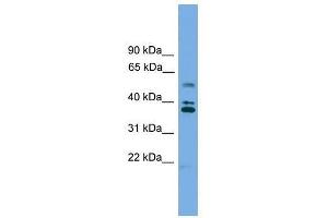 Western Blot showing LDLRAD3 antibody used at a concentration of 1-2 ug/ml to detect its target protein.