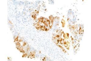 Immunohistochemistry (IHC) image for anti-Indoleamine 2,3-Dioxygenase 1 (IDO1) (AA 1-403) antibody (ABIN7449541) (Recombinant IDO1 anticorps  (AA 1-403))