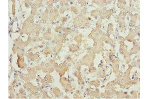 Immunohistochemistry of paraffin-embedded human liver tissue using ABIN7143362 at dilution of 1:100