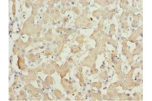 Immunohistochemistry of paraffin-embedded human liver tissue using ABIN7143362 at dilution of 1:100 (MOCS3 anticorps  (AA 271-460))