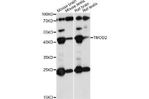 Western blot analysis of extracts of various cell lines, using TMOD2 antibody (ABIN6291659) at 1:1000 dilution. (TMOD2 anticorps)