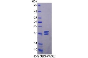 SDS-PAGE of Protein Standard from the Kit (Highly purified E. (MMP13 Kit CLIA)