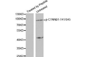 Western blot analysis of extracts from SW626 cells using Phospho-CTNNB1-T41/S45 antibody. (CTNNB1 anticorps  (pSer45, pThr41))
