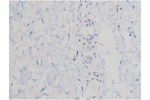 ABIN6267470 at 1/200 staining Human esophagus tissue sections by IHC-P.