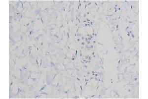 ABIN6267470 at 1/200 staining Human esophagus tissue sections by IHC-P. (AKT1 anticorps  (pThr450))