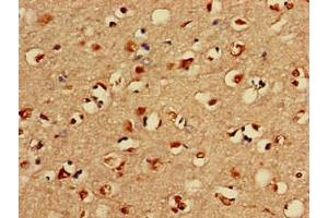 Immunohistochemistry of paraffin-embedded human brain tissue using ABIN7158354 at dilution of 1:100 (LIM Domain Kinase 1 anticorps  (AA 179-320))
