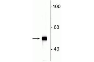 Western blot of rat cerebellar lysate showing specific immunolabeling of the ~57 kDa peripherin protein.