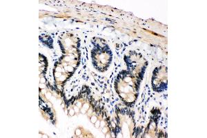 Anti-PLK2 antibody, IHC(P) IHC(P): Rat Intestine Tissue (PLK2 anticorps  (C-Term))