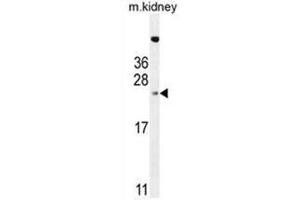 ADO Antibody (C-term) western blot analysis in mouse kidney tissue lysates (35µg/lane). (ADO anticorps  (C-Term))