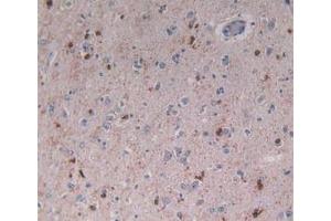 IHC-P analysis of Human Brain Tissue, with DAB staining. (Beclin 1 anticorps  (AA 1-273))
