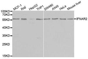 Western blot analysis of extracts of various cell lines, using IFNAR2 antibody. (IFNAR2 anticorps  (AA 27-243))