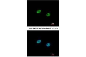ICC/IF Image Immunofluorescence analysis of paraformaldehyde-fixed HeLa, using IRF5, antibody at 1:500 dilution.