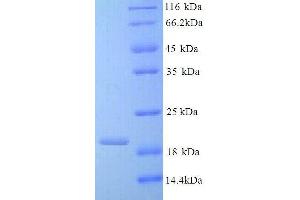 Interleukin 10 (IL10) (AA 19-178), (full length) protein (His tag) (IL-10 Protein (AA 19-178, full length) (His tag))
