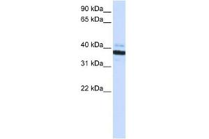 OAS1 antibody used at 1 ug/ml to detect target protein.