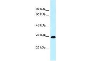 Image no. 1 for anti-DNA-Damage Regulated Autophagy Modulator 1 (DRAM1) (N-Term) antibody (ABIN6747924) (DRAM anticorps  (N-Term))