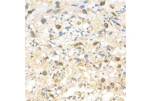 Immunohistochemistry analysis of paraffin-embedded rat placenta using EIF2S2 (ABIN7073880) at dilution of 1: 1000