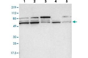 Western blot analysis of lane 1: RT-4, lane 2: EFO-21, lane 3: A-431, lane 4: Liver and lane 5: Tonsil using PCTK1 polyclonal antibody .