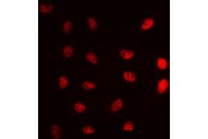 anti-DNA Repair Protein Complementing XP-G Cells (ERCC5) (N-Term) antibody