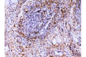IHC analysis of VCAM1 using anti-VCAM1 antibody .