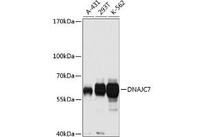 Western blot analysis of extracts of various cell lines, using DN antibody (ABIN3016674, ABIN3016675, ABIN3016676 and ABIN6219809) at 1:1000 dilution. (DNAJC7 anticorps  (AA 230-380))