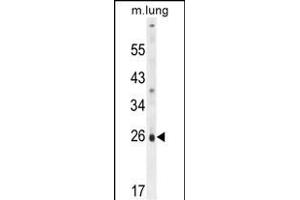 PQLC1 Antibody (Center) (ABIN654821 and ABIN2844494) western blot analysis in mouse lung tissue lysates (35 μg/lane).