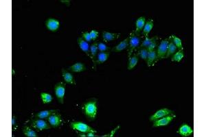 Immunofluorescent analysis of HepG2 cells using ABIN7155621 at dilution of 1:100 (HLA-B anticorps  (AA 25-308))