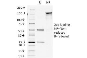 SDS-PAGE Analysis Purified Insulin Mouse Monoclonal Antibody (E2-E3+2D11-H5).
