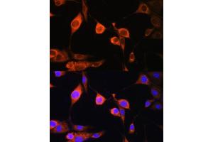 Immunofluorescence analysis of NIH/3T3 cells using D antibody (ABIN6129731, ABIN6137329, ABIN6137330 and ABIN6225254) at dilution of 1:100.
