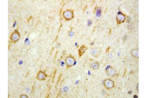 Anti-GAD65 antibody, IHC(P) IHC(P): Rat Brain Tissue (GAD65 anticorps  (N-Term))