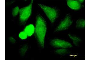 Immunofluorescence of monoclonal antibody to COPS3 on HeLa cell.