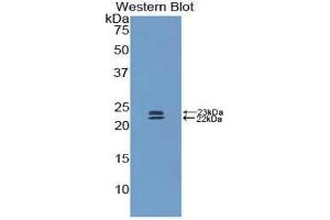 Western Blotting (WB) image for anti-Bone Morphogenetic Protein 1 (BMP1) (AA 856-982) antibody (ABIN1173363) (BMP1 anticorps  (AA 856-982))