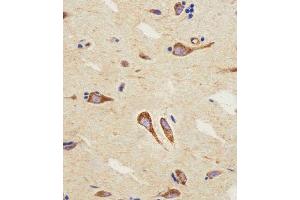 Immunohistochemical analysis of paraffin-embedded H. (CNR2 anticorps  (C-Term))