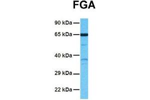 Host:  Rabbit  Target Name:  FGA  Sample Tissue:  Human NCI-H226  Antibody Dilution:  1. (FGA anticorps  (Middle Region))
