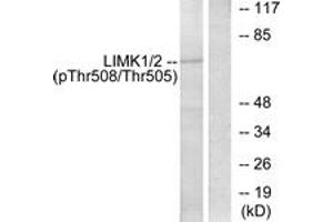 Western blot analysis of extracts from COLO205 cells, using LIMK1 (Phospho-Thr508) Antibody. (LIM Domain Kinase 1 anticorps  (pThr508))