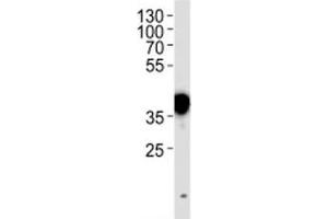 NPM1 antibody western blot analysis in HeLa lysate. (NPM1 anticorps  (AA 7-33))