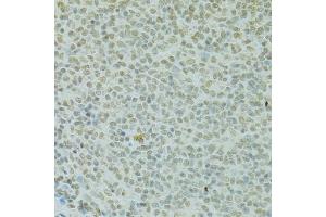 Immunohistochemistry of paraffin-embedded rat spleen using RCC1 antibody (ABIN5973761) at dilution of 1/100 (40x lens). (RCC1 anticorps)
