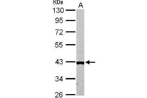 WB Image Arginase II antibody detects ARG2 protein by Western blot analysis.