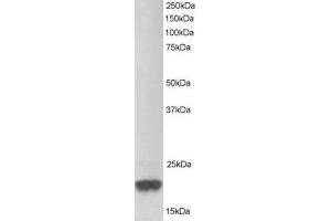 Image no. 1 for anti-Parkinson Protein 7 (PARK7) (C-Term) antibody (ABIN374310) (PARK7/DJ1 anticorps  (C-Term))