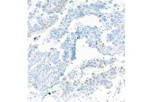Immunohistochemistry (IHC) image for anti-SRY (Sex Determining Region Y)-Box 2 (SOX2) antibody (ABIN7449421)