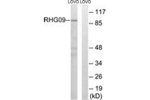 Western blot analysis of extracts from LOVO cells, using RHG9 Antibody. (ARHGAP9 anticorps  (AA 220-269))
